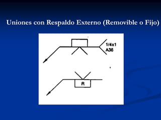 Uniones con Respaldo Externo (Removible o Fijo)
 