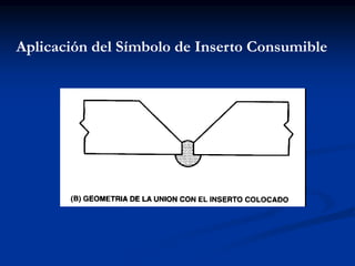 Aplicación del Símbolo de Inserto Consumible
 