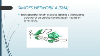 SIMOES NETWORK 4 (SN4)
 Estos aparatos llevan escudos labiales o vestibulares
para tratar de producir la excitación neutral en
el vestíbulo. 

 