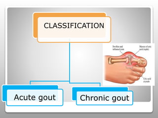 CLASSIFICATION
Acute gout Chronic gout
 
