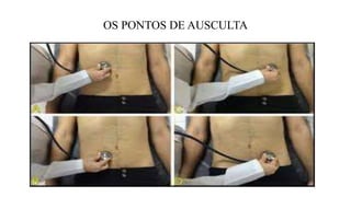 OS PONTOS DE AUSCULTA
 