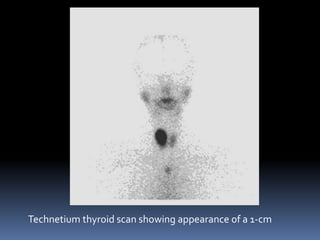 Thyroid Gland - part 1 | PPTX