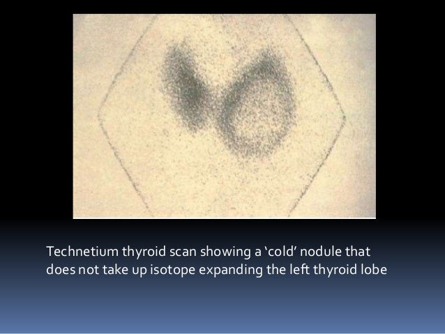 Thyroid Gland - part 1