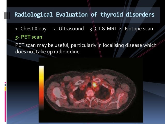 Thyroid Gland - part 1