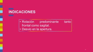 INDICACIONES
12
• Rotación predominante tanto
frontal como sagital.
• Desvio en la apertura.
 