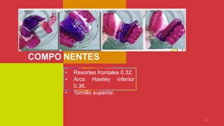COMPO
13
NENTES
• Resortes frontales 0.32.
• Arco Hawley inferior
0.36.
• Tornillo superior.
 