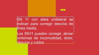 SN 11 con aleta unilateral se
indican para corregir desvíos de
línea media.
Los SN11 pueden corregir, aliviar
síntomas de incomodidad, dolor,
desvíos y ruidos
 