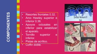 COMPONENTES
7
• Resortes frontales 0.32.
• Arco Hawley superior e
inferior 0.36.
• Apoyos oclusales en
inferior para estabilizar
el aparato.
• Tornillo superior e
inferior.
• Pistas de acrílico.
• Coffin doble.
 