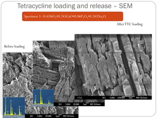 Tetracycline loading and release –SEM 
Before loading 
After TTC loading 
Specimen 3 : 0.45SiO2•0.245CaO•0.06P2O5•0.245Na2O  