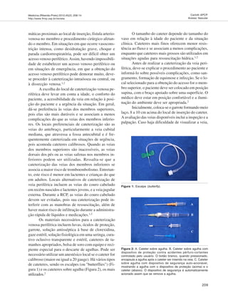 Medicina (Ribeirão Preto) 2012;45(2): 208-14
http://www.fmrp.usp.br/revista
209
Carlotti APCP.
Acesso Vascular
máticas proximais ao local de inserção, fístula arterio-
venosa no membro e procedimento cirúrgico afetan-
do o membro. Em situações em que ocorre vasocons-
trição intensa, como desidratação grave, choque e
parada cardiorrespiratória, pode ser difícil obter um
acesso venoso periférico.Assim, havendo impossibili-
dade de estabelecer um acesso venoso periférico ou
em situações de emergência, em que a obtenção do
acesso venoso periférico pode demorar muito, deve-
se proceder à cateterização intraóssea ou central, ou
à dissecção venosa.1,2
A escolha do local de cateterização venosa pe-
riférica deve levar em conta a idade, o conforto do
paciente, a acessibilidade da veia em relação à posi-
ção do paciente e a urgência da situação. Em geral,
dá-se preferência às veias dos membros superiores,
pois elas são mais duráveis e se associam a menos
complicações do que as veias dos membros inferio-
res. Os locais preferenciais de cateterização são as
veias do antebraço, particularmente a veia cubital
mediana, que atravessa a fossa antecubital e é fre-
quentemente cateterizada em situações de urgência,
pois acomoda cateteres calibrosos. Quando as veias
dos membros superiores são inacessíveis, as veias
dorsais dos pés ou as veias safenas nos membros in-
feriores podem ser utilizadas. Ressalta-se que a
cateterização das veias dos membros inferiores se
associa a maior risco de tromboembolismo. Entretan-
to, este risco é menor em lactentes e crianças do que
em adultos. Locais alternativos de cateterização de
veia periférica incluem as veias do couro cabeludo
em recém-nascidos e lactentes jovens, e a veia jugular
externa. Durante a RCP, as veias do couro cabeludo
devem ser evitadas, pois sua cateterização pode in-
terferir com as manobras de ressuscitação, além de
haver maior risco de infiltração durante a administra-
ção rápida de líquidos e medicações.1,2
Os materiais necessários para a cateterização
venosa periférica incluem luvas, óculos de proteção,
garrote, solução antisséptica à base de clorexidina,
gaze estéril, solução fisiológica em uma seringa, cura-
tivo oclusivo transparente e estéril, cateteres de ta-
manhos apropriados, bolsa de soro com equipo e reci-
piente especial para o descarte de agulhas. Pode ser
necessário utilizar um anestésico local se o cateter for
calibroso (maior ou igual a 20 gauge). Há vários tipos
de cateteres, sendo os escalpes (ou "butterflies") (Fi-
gura 1) e os cateteres sobre agulha (Figura 2), os mais
utilizados.2
O tamanho do cateter depende do tamanho do
vaso em relação à idade do paciente e da situação
clínica. Cateteres mais finos oferecem menor resis-
tência ao fluxo e se associam a menos complicações,
enquanto que cateteres mais grossos são utilizados em
situações agudas para ressuscitação hídrica.1,2
Antes de realizar a cateterização da veia peri-
férica, deve-se explicar o procedimento ao paciente e
informá-lo sobre possíveis complicações, como san-
gramento, formação de equimose e infecção. Se o lo-
cal selecionado para a obtenção do acesso for o mem-
bro superior, o paciente deve ser colocado em posição
supina, com o braço apoiado sobre uma superfície. O
médico deve estar em posição confortável e a ilumi-
nação do ambiente deve ser apropriada.2
Inicialmente, coloca-se o garrote formando meio
laço, 8 a 10 cm acima do local de inserção do cateter.
A avaliação das veias disponíveis inclui a inspeção e a
palpação. Caso haja dificuldade de visualizar a veia,
Figura 1: Escalpe (butterfly).
Figura 2: A. Cateter sobre agulha. B. Cateter sobre agulha com
dispositivo de proteção contra acidentes pérfuro-cortantes
controlado pelo usuário. O botão branco, quando pressionado,
encapsula a agulha após o cateter ser inserido na veia. C. Cateter
sobre agulha com dispositivo de segurança auto-acionável,
mostrando a agulha com o dispositivo de proteção (acima) e o
cateter (abaixo). O dispositivo de segurança é automaticamente
acionado assim que se remove a agulha.
 