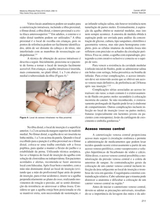 Medicina (Ribeirão Preto) 2012;45(2): 208-14
http://www.fmrp.usp.br/revista
211
Carlotti APCP.
Acesso Vascular
Vários locais anatômicos podem ser usados para
a cateterização intraóssea, incluindo a tíbia proximal,
o fêmur distal, a tíbia distal, o úmero proximal e a cris-
ta ilíaca anterossuperior.1,4 Em adultos, o esterno e o
rádio distal também podem ser utilizados.5
A tíbia
proximal é o local de escolha em crianças, pois os
pontos de referência podem ser facilmente identifica-
dos, além de ser distante da cabeça e do tórax, não
interferindo com as manobras de ressuscitação car-
diopulmonar.1,4
A técnica de obtenção do acesso intraósseo é
descrita a seguir. Inicialmente, posiciona-se o pacien-
te de forma a tornar o local de inserção facilmente
acessível. Em crianças, a agulha intraóssea é inserida,
mais comumente, no platô tibial, 1 a 3 cm abaixo e
medial à tuberosidade da tíbia (Figura 4).1
Figura 4: Local do acesso intraósseo na tíbia proximal.
Na tíbia distal, o local de inserção é a superfície
anterior, 1 a 2 cm acima da margem superior do maléolo
medial. No fêmur distal, a agulha deve ser inserida na
linha média, 1 a 3 cm acima da patela. Quando o local
escolhido para a punção é a tíbia proximal ou o fêmur
distal, coloca-se uma toalha enrolada sob a fossa
poplítea, para ajudar a manter a flexão do joelho e a
estabilidade da perna. Utilizando técnica asséptica,
faz-se a limpeza do local de inserção da agulha com
solução de clorexidina ou iodopovidona. Em pacientes
acordados e alertas, recomenda-se fazer anestesia
local com lidocaína.Após fixar bem o membro, com a
mão não dominante distal ao local de inserção (evi-
tando que a mão do profissional fique atrás do ponto
de inserção, para evitar acidentes), insere-se a agulha
perpendicularmente ao plano do osso, realizando mo-
vimentos de rotação e pressão, até se sentir diminui-
ção da resistência ao atravessar a tábua óssea. Con-
sidera-se que a agulha esteja bem posicionada se ela
se mantiver ereta, sem necessidade de sustentação, e
ao infundir solução salina, não houver resistência nem
tumefação de partes moles. Eventualmente, à aspira-
ção da agulha obtém-se material medular, mas isto
nem sempre acontece. A amostra de medula obtida à
aspiração pode ser enviada para análise da concen-
tração de glicose, cultura, tipo sanguíneo, eletrólitos e
gasometria venosa, mas não para hemograma com-
pleto, pois as células imaturas da medula óssea não
refletem com precisão os achados da circulação peri-
férica. Fixa-se, então, a agulha com esparadrapo, pro-
tegendo-a com curativo oclusivo e conecta-se o equi-
po de soro.
Para vencer a resistência da cavidade medular
à infusão inicial de fluidos, pode-se administrar salina
em bolus com seringa, bolsa pressórica ou bomba de
infusão. Para evitar complicações, o acesso intraós-
seo deve ser removido assim que se obtiver um aces-
so venoso mais definitivo, de preferência até 24 horas
após sua inserção.1,3,4
Complicações sérias associadas ao acesso in-
traósseo são raras; a mais comum é o extravasamen-
to de fluido em partes moles secundário à colocação
incorreta do cateter. Se não reconhecido, o extrava-
samento prolongado de líquido pode levar à síndrome
de compartimento. Outras complicações incluem in-
fecção no local de inserção (osso ou partes moles),
fraturas (especialmente em lactentes jovens ou pa-
cientes com osteopenia), lesão da cartilagem de cres-
cimento e embolia gordurosa.4
Acesso venoso centralAcesso venoso centralAcesso venoso centralAcesso venoso centralAcesso venoso central
A cateterização venosa central proporciona
acesso mais seguro à circulação sistêmica e permite
a administração de medicamentos que podem lesar
tecidos quando ocorre extravasamento a partir de um
acesso venoso periférico, como vasopressores e solu-
ções hipertônicas de bicarbonato de sódio e cálcio.
Além disso, o acesso venoso central possibilita a mo-
nitorização da pressão venosa central e a coleta de
amostras de sangue. As contraindicações gerais da
colocação de um cateter venoso central incluem in-
fecção da área subjacente ao local de inserção e trom-
bose da veia em questão. Coagulopatia constitui con-
traindicação relativa. Cabe salientar que o trauma pode
distorcer a anatomia e dificultar a colocação de um
cateter venoso central na região.6
Antes de iniciar o cateterismo venoso central,
devem-se adotar as precauções universais, ressaltan-
do-se a importância da lavagem das mãos e da ado-
 