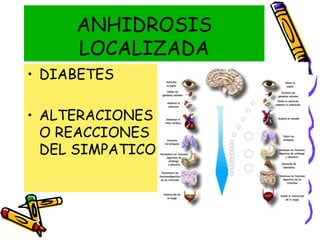 ANHIDROSIS
LOCALIZADA
• DIABETES
• ALTERACIONES
O REACCIONES
DEL SIMPATICO
 