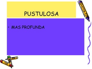 PUSTULOSA
• MAS PROFUNDA
 