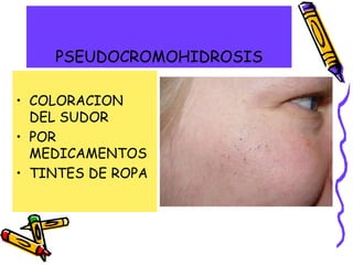 PSEUDOCROMOHIDROSIS
• COLORACION
DEL SUDOR
• POR
MEDICAMENTOS
• TINTES DE ROPA
 