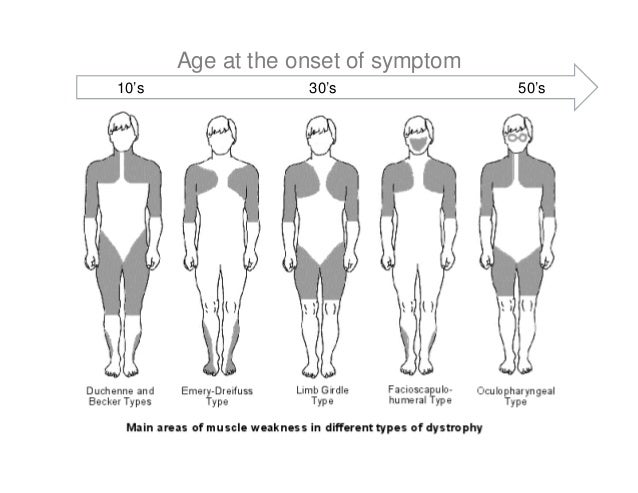 4 Steps simple approach myopathy