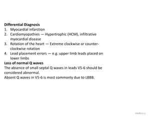Extreme Counterclockwise Rotation Ecg simple ecg learningMEM.pptx