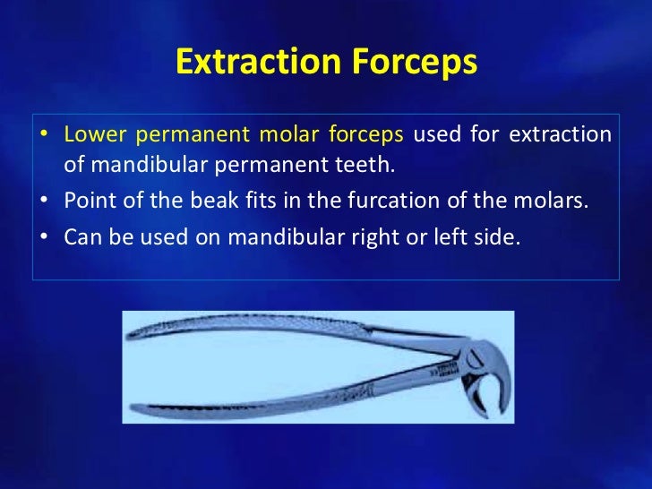 Simple tooth extraction technique