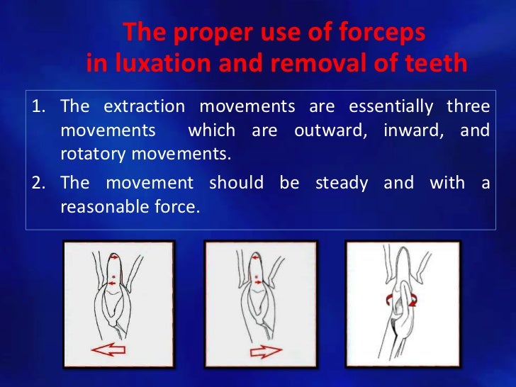 Simple tooth extraction technique