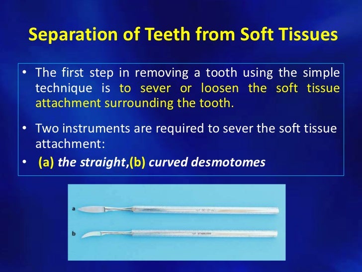 Simple tooth extraction technique