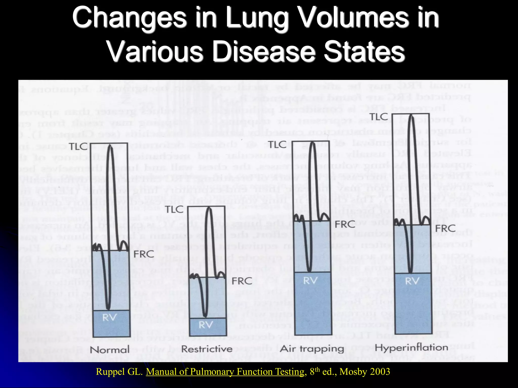 Changes in Lung Volumes in
Various Disease States

Ruppel GL. Manual of Pulmonary Function Testing, 8th ed., Mosby 2003

 