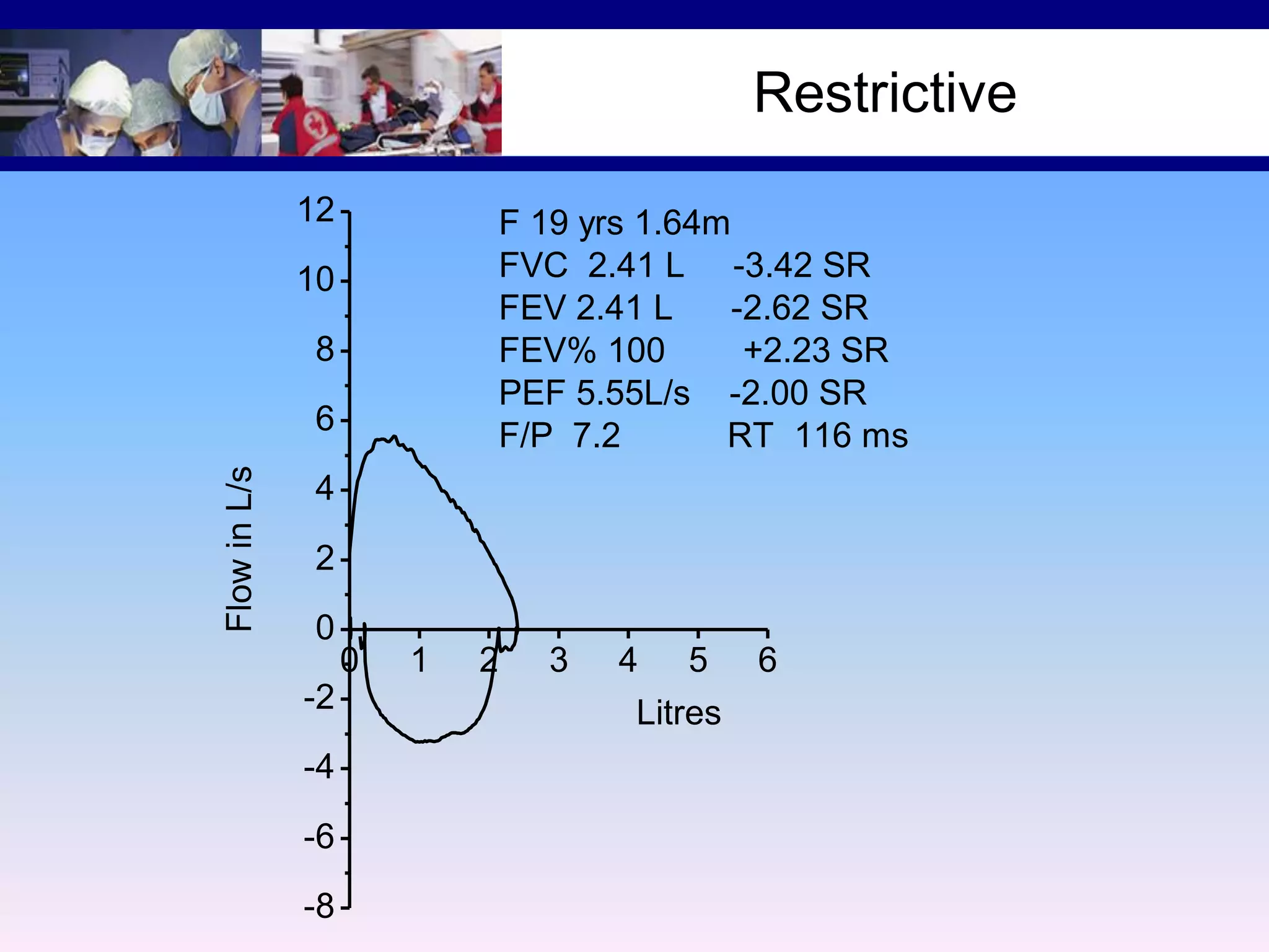 Restrictive
12

F 19 yrs 1.64m
FVC 2.41 L -3.42 SR
FEV 2.41 L
-2.62 SR
FEV% 100
+2.23 SR
PEF 5.55L/s -2.00 SR
F/P 7.2
RT 116 ms

10
8

Flow in L/s

6
4
2
0
0
-2
-4
-6
-8

1

2

3

4

5

Litres

6

 