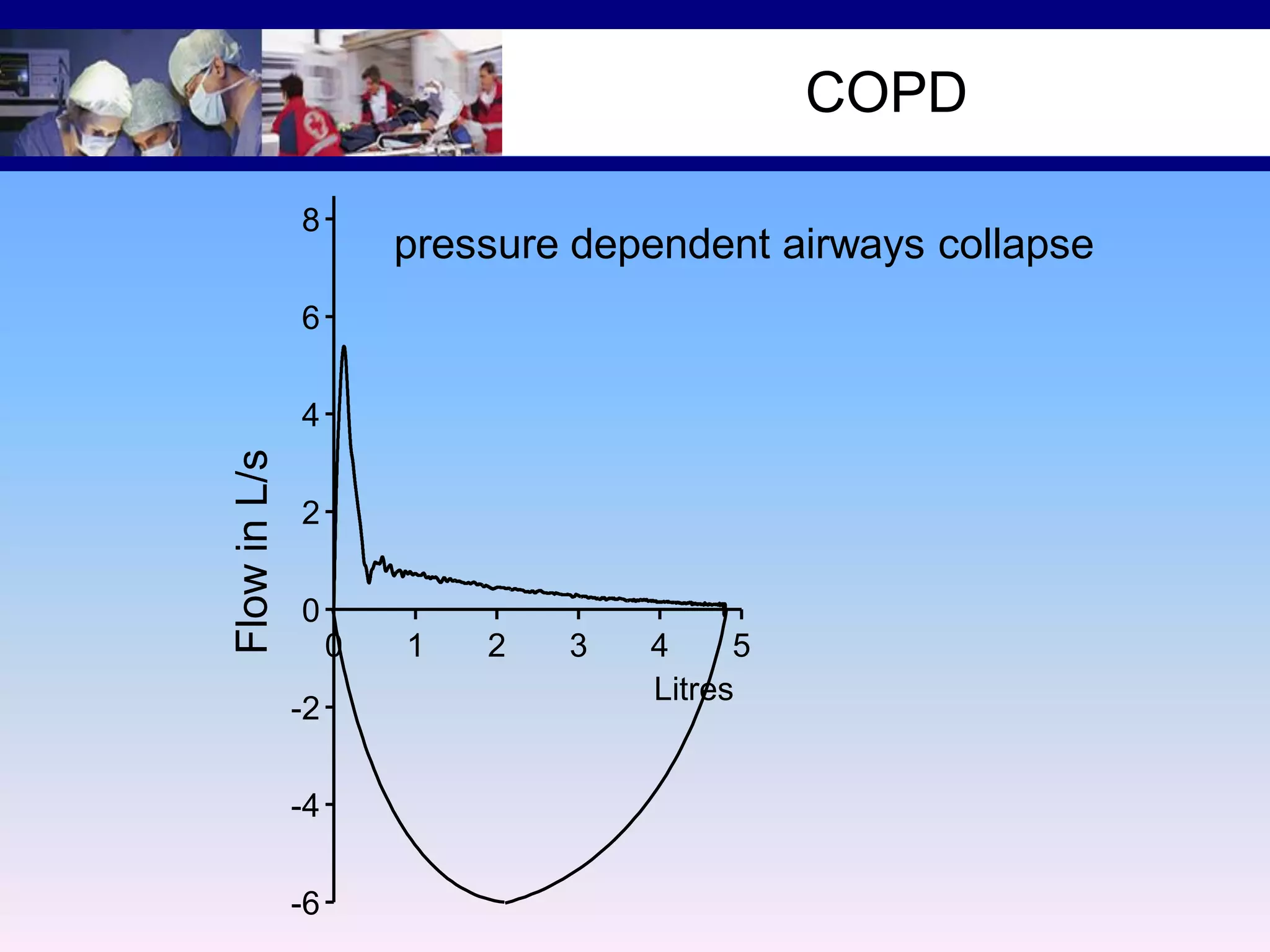 COPD

10
8

pressure dependent airways collapse

6

Flow in L/s

4
2
0
0
-2
-4
-6

1

2

3

4
5
Litres

 