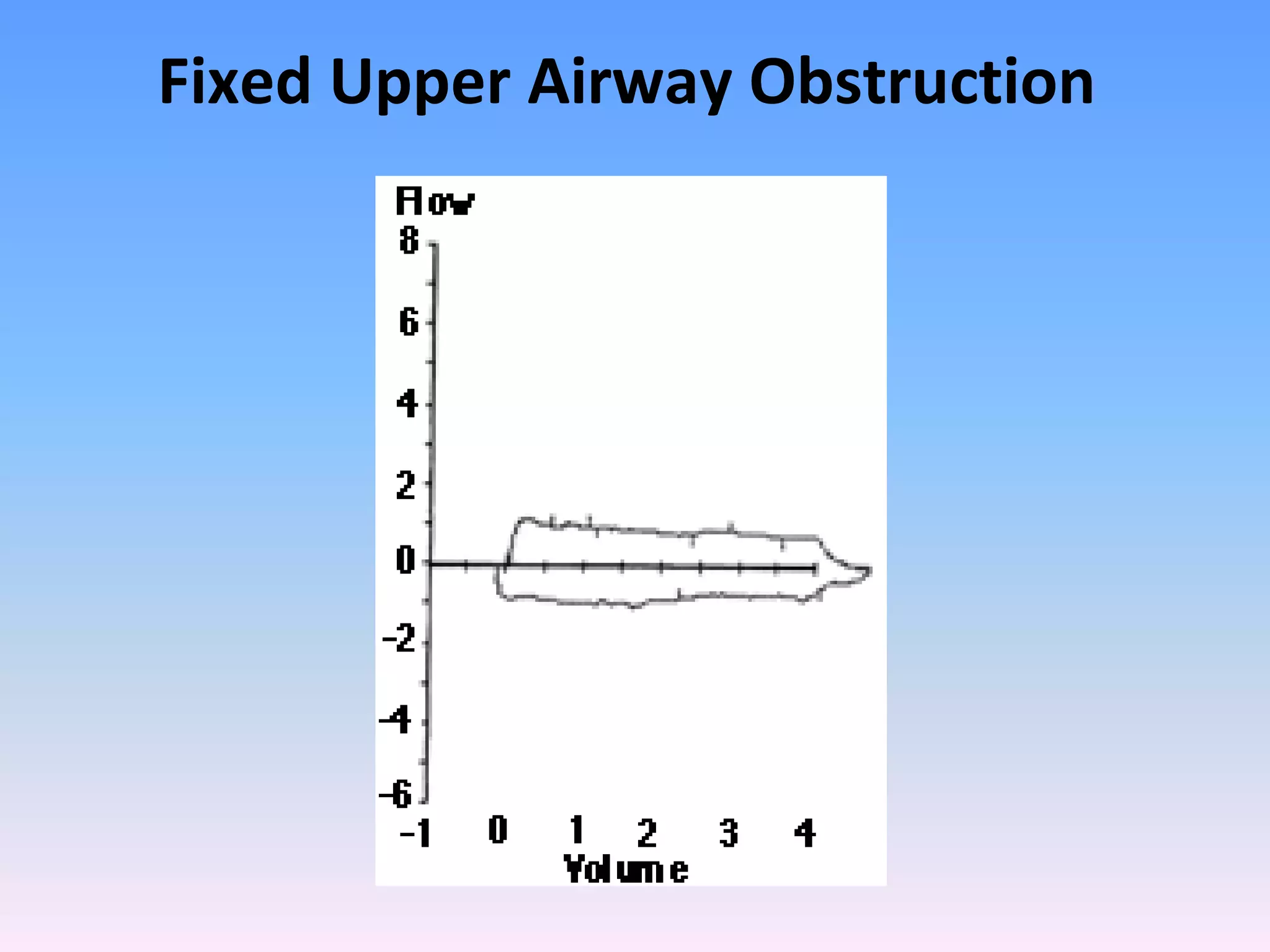 Fixed Upper Airway Obstruction

 