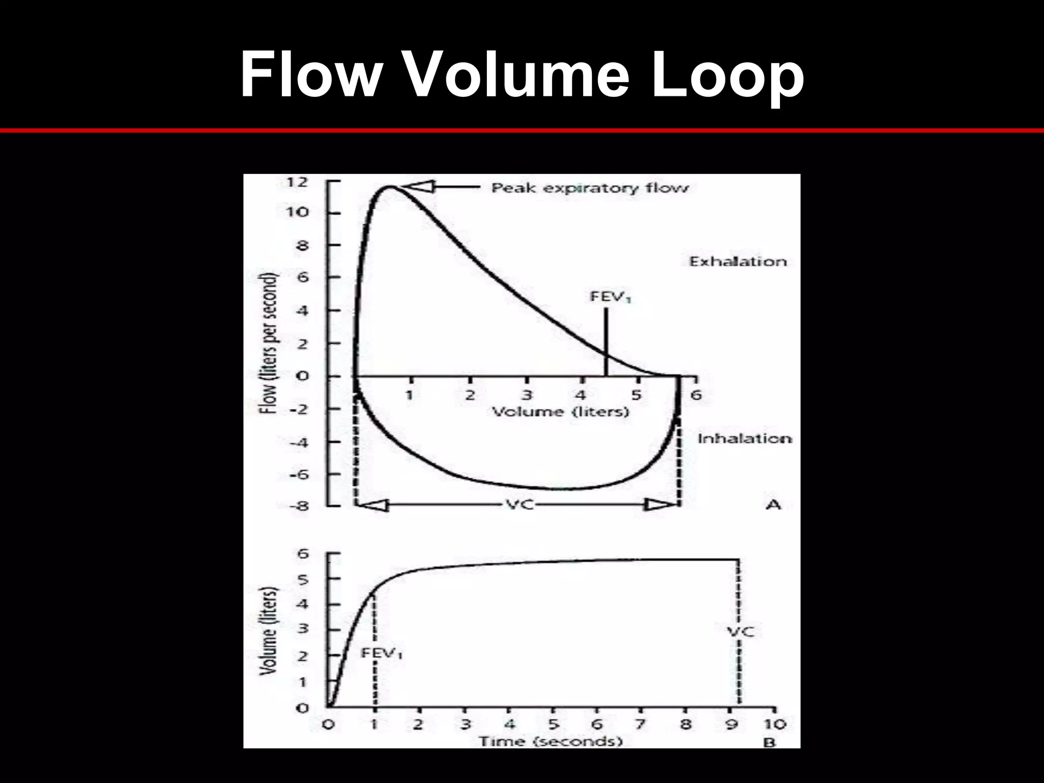 Flow Volume Loop

 