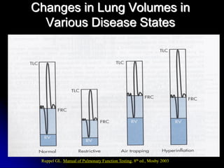 Changes in Lung Volumes in
Various Disease States

Ruppel GL. Manual of Pulmonary Function Testing, 8th ed., Mosby 2003

 