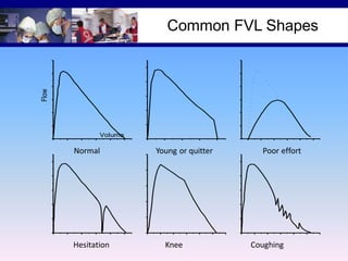 Flow

Common FVL Shapes

Volume

Normal

Hesitation

Young or quitter

Knee

Poor effort

Coughing

 