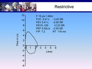 Restrictive
12

F 19 yrs 1.64m
FVC 2.41 L -3.42 SR
FEV 2.41 L
-2.62 SR
FEV% 100
+2.23 SR
PEF 5.55L/s -2.00 SR
F/P 7.2
RT 116 ms

10
8

Flow in L/s

6
4
2
0
0
-2
-4
-6
-8

1

2

3

4

5

Litres

6

 