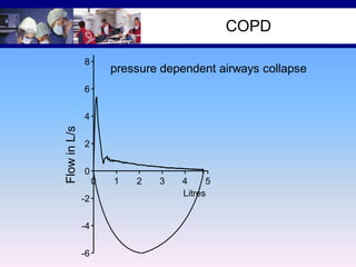 COPD

10
8

pressure dependent airways collapse

6

Flow in L/s

4
2
0
0
-2
-4
-6

1

2

3

4
5
Litres

 
