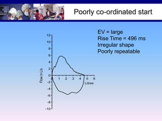 Poorly co-ordinated start
EV = large
Rise Time = 496 ms
Irregular shape
Poorly repeatable

12
10
8
6

Flow in L/s

4
2
0
0
-2
-4
-6
-8
-10

1

2

3

4

5

6

Litres

 