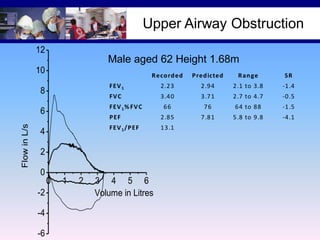Upper Airway Obstruction
12

Male aged 62 Height 1.68m
10

R e co rd e d

SR

2.23

2.94

2.1 to 3.8

-1.4

FV C

3.40

3.71

2.7 to 4.7

-0.5

66

76

64 to 88

-1.5

P EF

2.85

7.81

5.8 to 9.8

-4.1

FEV 1 /P EF

13.1

FEV 1 % FV C

6
Flow in L/s

R an ge

FEV 1

8

P re d icte d

4
2
0
0
-2
-4
-6

1

2

3 4 5 6
Volume in Litres

 