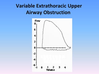 Variable Extrathoracic Upper
Airway Obstruction

 