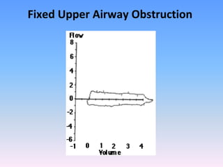 Fixed Upper Airway Obstruction

 