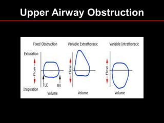 Upper Airway Obstruction

 