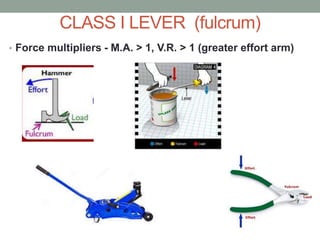 CLASS I LEVER (fulcrum)
• Force multipliers - M.A. > 1, V.R. > 1 (greater effort arm)