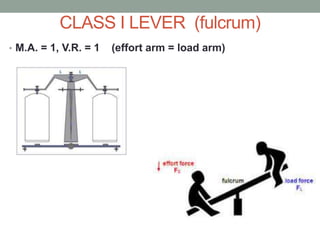CLASS I LEVER (fulcrum)
• M.A. = 1, V.R. = 1 (effort arm = load arm)