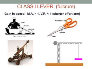 CLASS I LEVER (fulcrum)
• Gain in speed - M.A. < 1, V.R. < 1 (shorter effort arm)