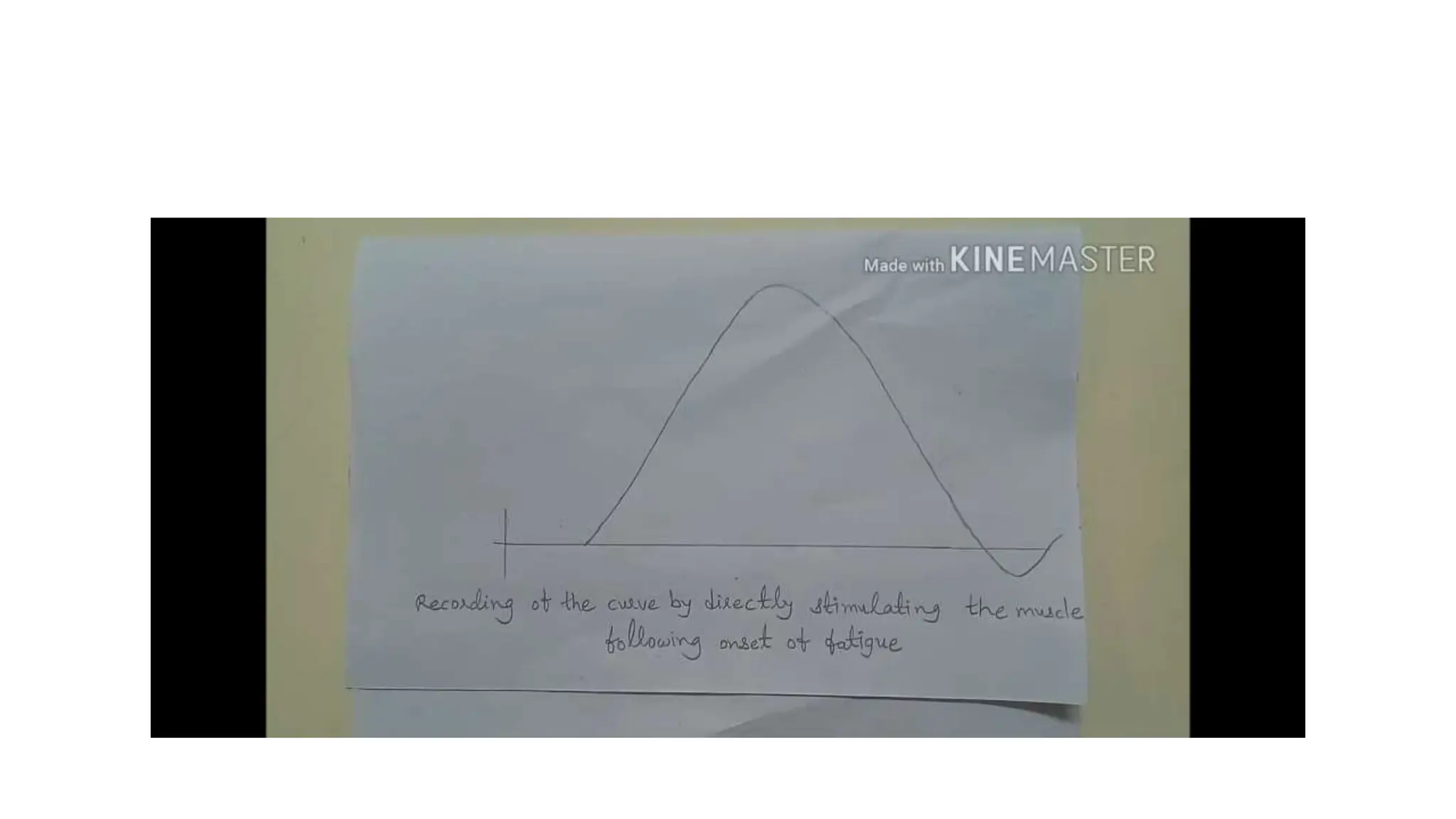 simple muscle twitch Practical guide to identify muscle twitch