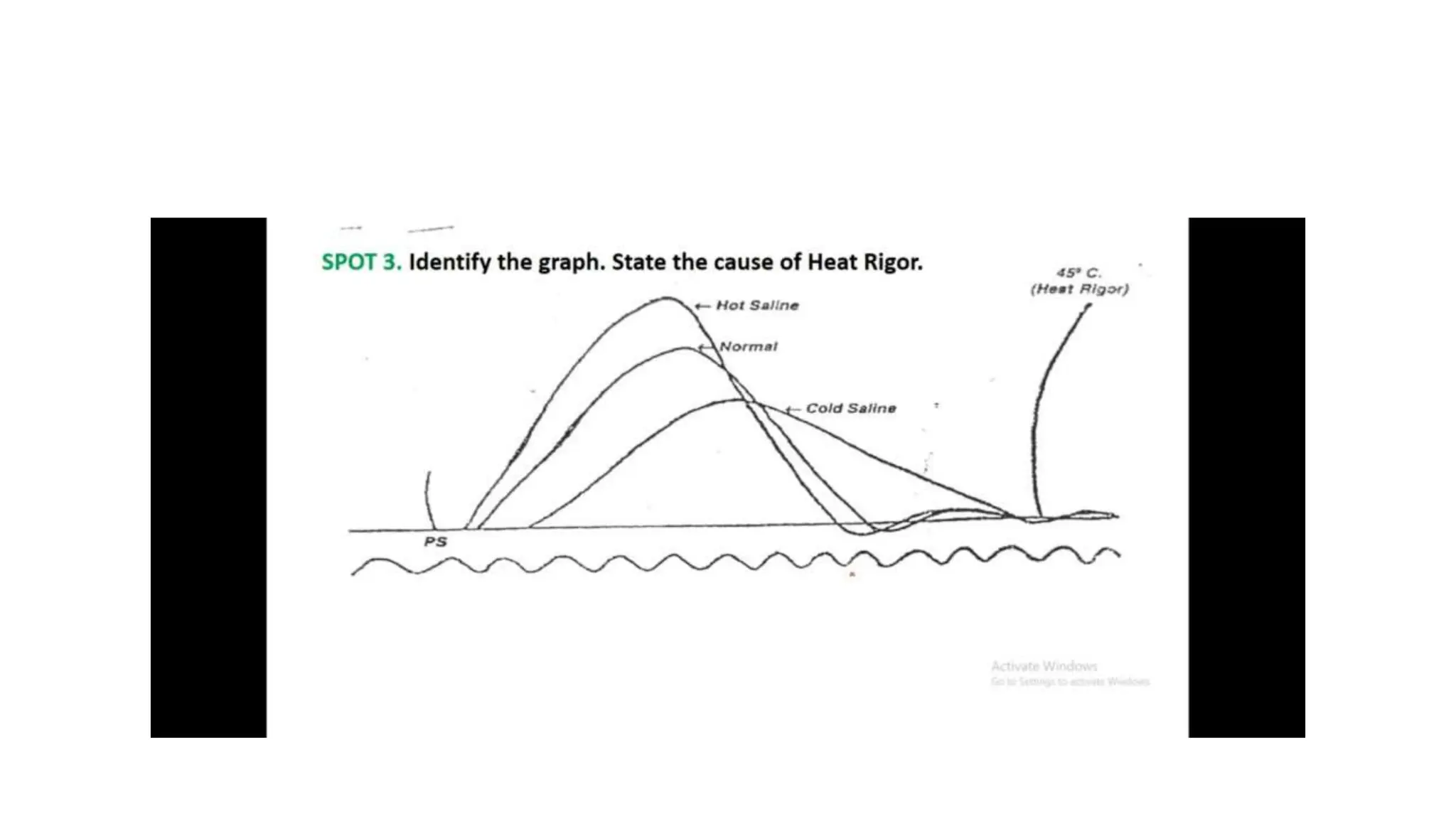simple muscle twitch Practical guide to identify muscle twitch