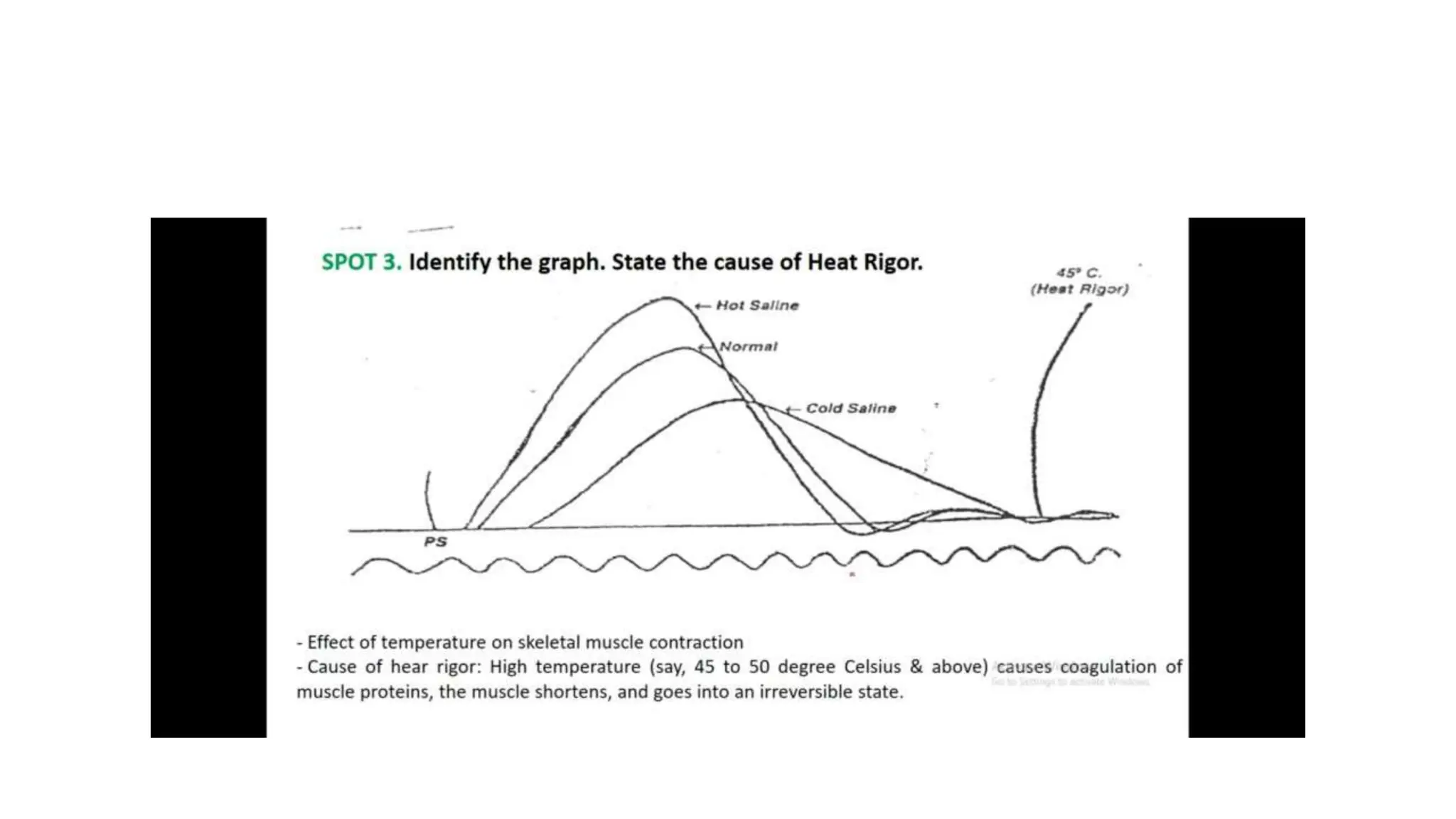 simple muscle twitch Practical guide to identify muscle twitch