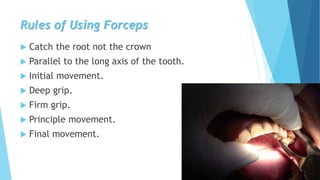 Rules of Using Forceps
 Catch the root not the crown
 Parallel to the long axis of the tooth.
 Initial movement.
 Deep grip.
 Firm grip.
 Principle movement.
 Final movement.
 