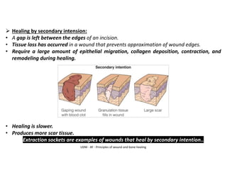 UDM - AY - Principles of wound and bone healing
➢ Healing by secondary intension:
• A gap is left between the edges of an incision.
• Tissue loss has occurred in a wound that prevents approximation of wound edges.
• Require a large amount of epithelial migration, collagen deposition, contraction, and
remodeling during healing.
• Healing is slower.
• Produces more scar tissue.
Extraction sockets are examples of wounds that heal by secondary intention..
 