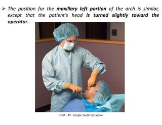 UDM - AY - Simple Tooth Extraction
➢ The position for the maxillary left portion of the arch is similar,
except that the patient’s head is turned slightly toward the
operator..
 
