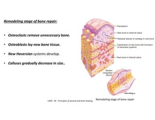 Remodeling stage of bone repair:
• Osteoclasts remove unnecessary bone.
• Osteoblasts lay new bone tissue.
• New Haversian systems develop.
• Calluses gradually decrease in size..
Remodeling stage of bone repair
UDM - AY - Principles of wound and bone healing
 