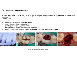UDM - AY - Perioperative Comp. of Tooth Ex.
❑ Prevention of Complications
1. The best and easiest way to manage a surgical complication is to prevent it from ever
happening;
• Thorough preoperative assessment.
• Comprehensive treatment plan.
• Careful execution of the surgical procedure.
• The complication is often predictable and can be managed routinely.
 