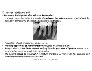 UDM - AY - Perioperative Comp. of Tooth Ex.
❑ Injuries To Adjacent Teeth
I. Fracture or Dislodgment of an Adjacent Restoration:
➢ If a large restoration exists, the dentist should warn the patient preoperatively about the
possibility of fracturing or displacing it during the extraction.
➢ Prevention of such a fracture or displacement:
• Avoiding application of instrumentation and force on the restoration.
• Straight elevator should be inserted entirely into the periodontal ligament space, or not
used at all to luxate the tooth before extraction.
• The patient should be informed if a fracture of a tooth or restoration has occurred and
that a replacement restoration is needed..
 