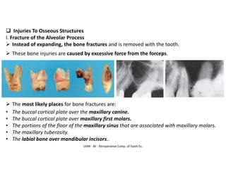 UDM - AY - Perioperative Comp. of Tooth Ex.
❑ Injuries To Osseous Structures
I. Fracture of the Alveolar Process
➢ Instead of expanding, the bone fractures and is removed with the tooth.
➢ These bone injuries are caused by excessive force from the forceps.
➢ The most likely places for bone fractures are:
• The buccal cortical plate over the maxillary canine.
• The buccal cortical plate over maxillary first molars.
• The portions of the floor of the maxillary sinus that are associated with maxillary molars.
• The maxillary tuberosity.
• The labial bone over mandibular incisors..
 